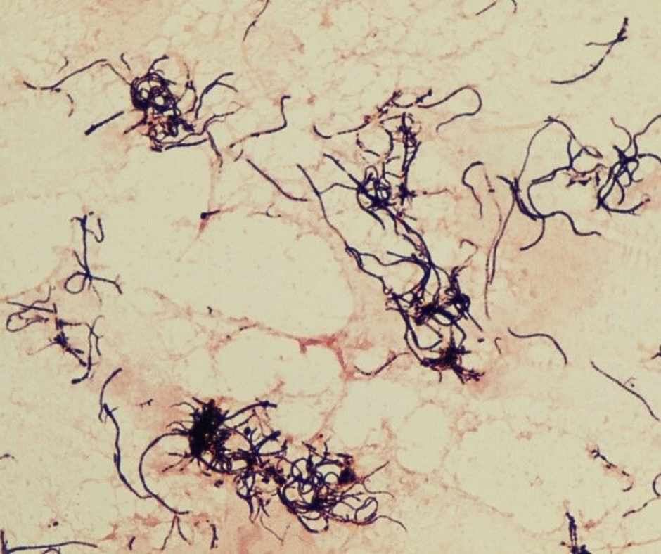 Dermatophilus congolensis - PCR diagnostika